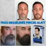 Haj- és szakállfesték ammónia nélkül, gyors felvitel és természetes eredmény 5 perc alatt, a Verilaria által - Image 7