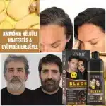 Fekete hajfestő sampon – gyorsan fedi az ősz hajszálakat, ammóniamentes, gyömbérrel, Sevich, 500 ml - Image 3