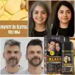 Fekete hajfestő sampon – gyorsan fedi az ősz hajszálakat, ammóniamentes, gyömbérrel, Sevich, 500 ml - Image 7