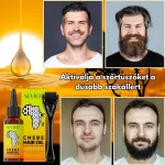 Szakállnövesztő szett – derma roller és Chebe olaj, biotin, sűrű és egészséges szakáll, Sevich - Image 7