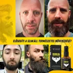 Szakállnövesztő készlet – derma roller, biotin, rozmaring, természetes stimulálás és táplálás, Sevich - Image 2