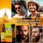 Szakállnövesztő szett – derma roller és Chebe olaj, biotin, sűrű és egészséges szakáll, Sevich - Image 2