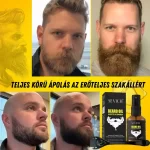 Szakállnövesztő készlet – derma roller, biotin, rozmaring, természetes stimulálás és táplálás, Sevich - Image 3