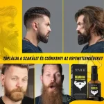 Szakállnövesztő készlet – derma roller, biotin, rozmaring, természetes stimulálás és táplálás, Sevich - Image 4