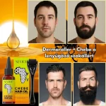 Szakállnövesztő szett – derma roller és Chebe olaj, biotin, sűrű és egészséges szakáll, Sevich - Image 6