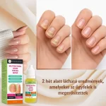 Intenzív körömápoló kezelés, hidratálás és erősítés, Verilaria, 10 ml - Image 3